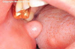 virgin getting poked by finger free spit fetish